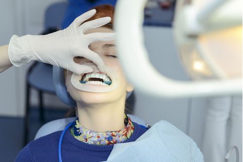 Aperfeiçoamento em Dentística Restauradora
